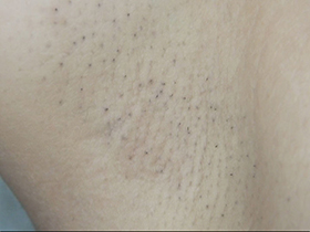 300人の腋 2　サンプル画像05